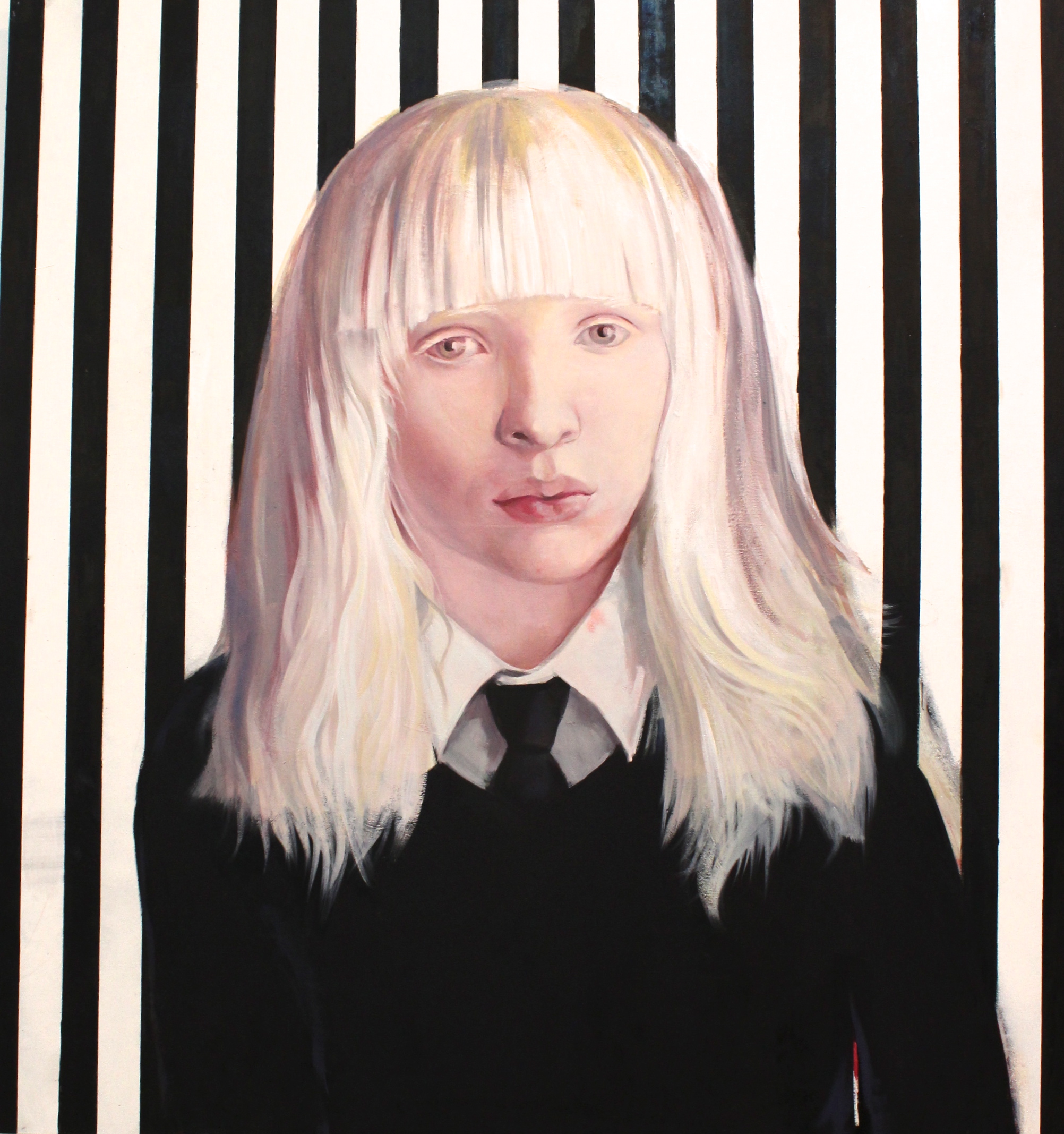albinos girl